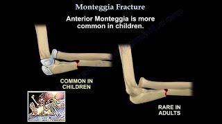 Radial Nerve Anatomy  Everything You Need To Know  Dr Nabil Ebraheim [upl. by Nayrbo164]