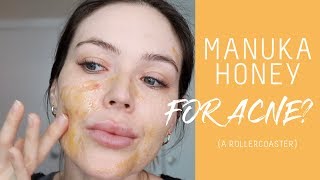 I tried manuka honey for acne  hyperpigmentation  Nicole Masifilo [upl. by Attenoj]