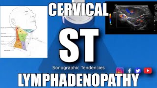 Sonoquickies  Cervical Lymphadenopathy [upl. by Etnovahs]