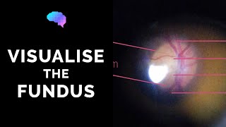 Fundoscopy  How to Visualise the Fundus  Direct Ophthalmoscopy  OSCE Guide  UKMLA  CPSA [upl. by Introc]