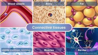 Osteosarcoma 101 Bone Pathology Basics [upl. by Matthias]