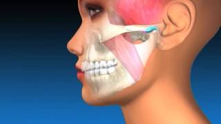 TMJ Explanation amp Therapy [upl. by Chester]