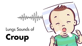 Sounds of Croup Laryngotracheitis  Lung Sounds  MEDZCOOL [upl. by Kursh]