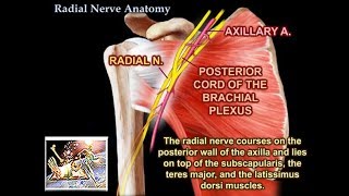 Radial tear posterior hornroot junction [upl. by Farrish]