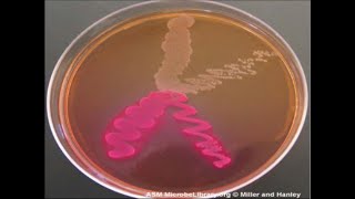 Micro Lab 6 Selective and Differential Media [upl. by Clifford]