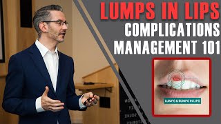 What are Neck MassesLumps How to Identify amp Examine them [upl. by Reinhardt]