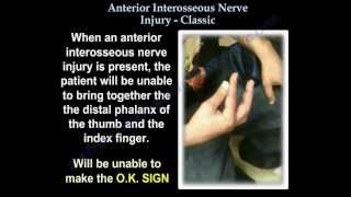 Anterior Interosseous Nerve Injury Classic  Everything You Need To Know  Dr Nabil Ebraheim [upl. by Deana]