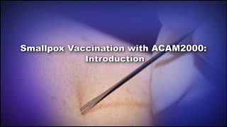 Chapter 1 Smallpox Vaccination with ACAM2000 Introduction [upl. by Ititrefen]