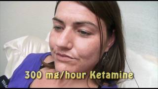 3Day Ketamine Treatment for Complex Regional Pain Syndrome [upl. by Divad429]