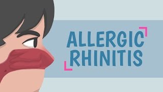 What is Allergic Rhinitis [upl. by Bouley]