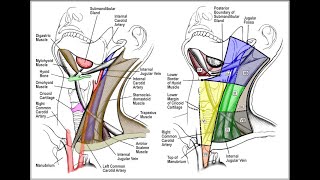 Tuberculosis of the Lymph Node  Histopathology [upl. by Nyleahcim]