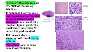 Lung with Lymph nodes TB Gross and Micro correlates [upl. by Colvin]