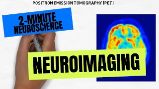 Radiographic Imaging Explained  Nuffield Health [upl. by Annuahs37]