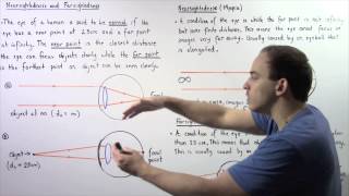 Correcting nearsightedness and farsightedness [upl. by Anahir]