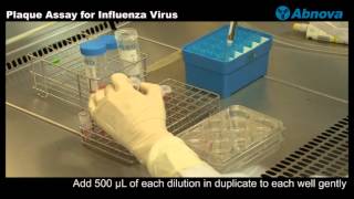 Plaque Assay for Influenza Virus [upl. by Nitsreik]