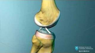 Knee Ligament Anatomy Animation [upl. by Aitnauq]