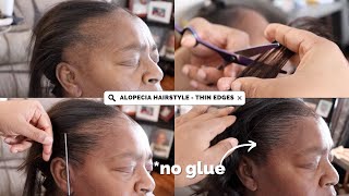 THIN EDGES TRANSFORMATION  TRACTION ALOPECIA HAIRSTYLE [upl. by Alleon]