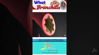 What is Bronchitis  Bronchitis Symptoms Causes and Treatment [upl. by Hplodur470]