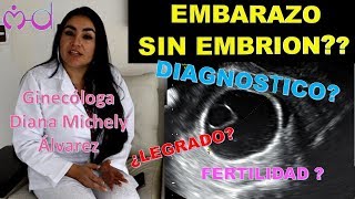 EMBARAZO ANEMBRIONADO POR GINECOLOGA DIANA ALVAREZ [upl. by Erdied]