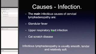 Cervical Lymphadenopathy [upl. by Muncey772]