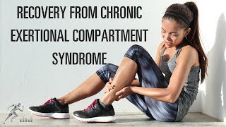 Recovery from chronic exertional compartment syndrome CECS [upl. by Ailima]