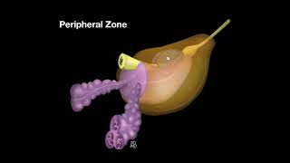 The 4 Types of Prostate Cancer Treatment  Prostate Cancer Staging Guide [upl. by Neeli]